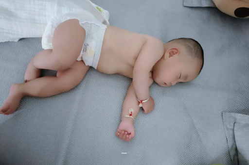 安康宝宝黄疸值多少才正常